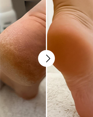 Softening foot cream with urea and shea butter Nutridome - 4